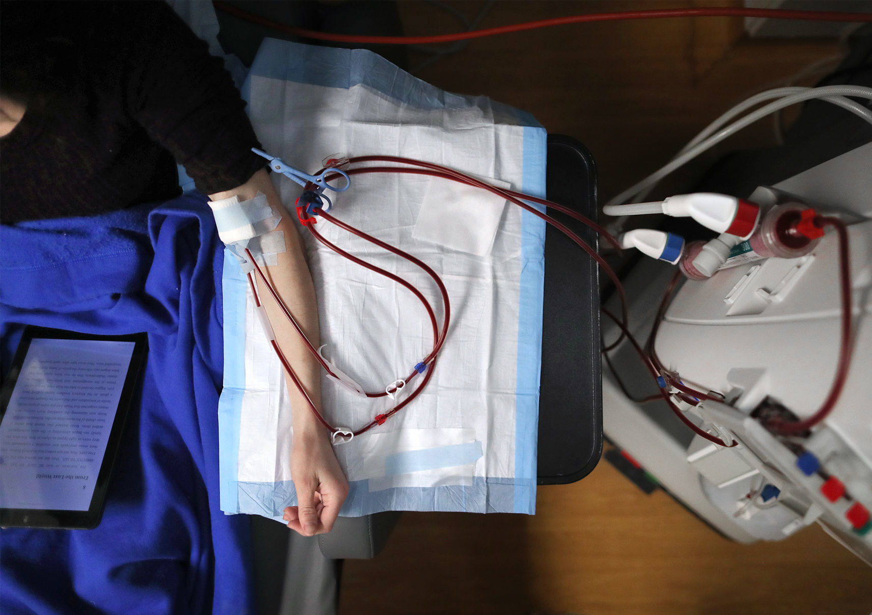 190304_KIDNEY02